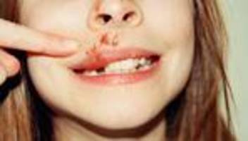 Terminservice- und Versorgungsgesetz: Schneller Termin? Das kostet!