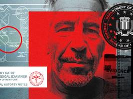 Medizin: Wie starb Epstein wirklich?