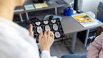 Ärzte halten Kopfschmerzen für Migräne: Nach 2 Monaten bekommt 19-Jährige eine Krebsdiagnose