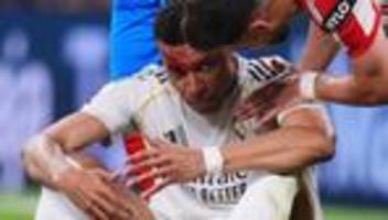 Champions League: Stürmerstar Mbappé nach Kopfwunde im Real-Kader für Bayern