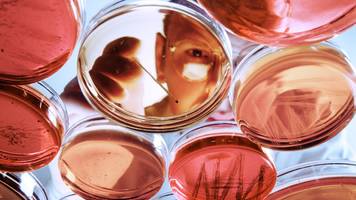 Medikamente: Effizientere Entwicklung mit KI und Petrischale