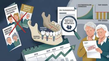 pkv-falle zahnarzt: worauf es bei tarifen wirklich ankommt