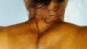 Nackenschmerzen: Alles auf meinen Nacken