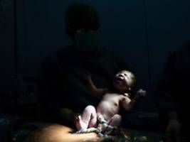 Höchste Kaiserschnittrate weltweit: Ägyptische Ärzte greifen im Kreißsaal gern zum Skalpell