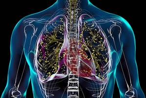 tuberkulose in bremer kita: 1 kind infiziert, 100 getestet