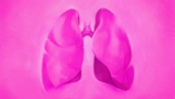 krebsfrüherkennung: wer gesund ist, muss nicht zum arzt. oder doch?