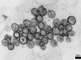 Medizin: Wie gefährlich ist das Hantavirus?
