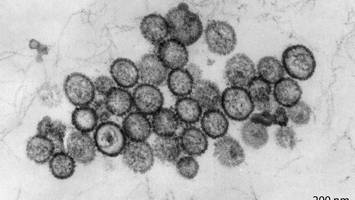rätselhafter virus-ausbruch auf kreuzfahrtschiff: drei tote im atlantik