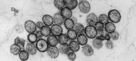 Hantavirus-Tote kommt aus Bayern: So viele Fälle sind im Freistaat bekannt