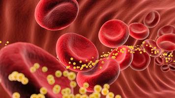 ldl-cholesterin schadet nicht nur dem herz! mit welchem wert sie demenz vorbeugen
