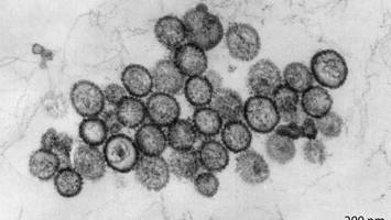 beim hantavirus ist wachsamkeit statt pandemie-panik gefragt