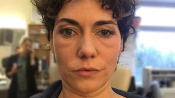 schauspielerin katrin lux bricht tv-dreh ab, als schminke gefährlich wird