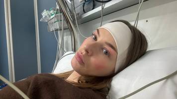 Was Ronja (26) als Stress abtut, entpuppt sich als Darmkrebs