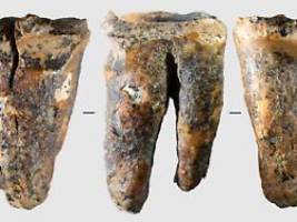 Schmerzhafter Eingriff: Studie: Neandertaler kannten bereits Zahnärzte