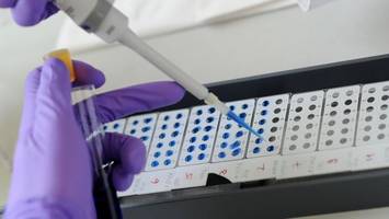 fälle von hantavirus auch in hamburg nachgewiesen – was das bedeutet
