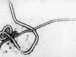 Warum ist es so tödlich?: Was man über das Ebolavirus weiß