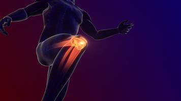das künstliche knie kann viel – aber eines oft nicht leisten