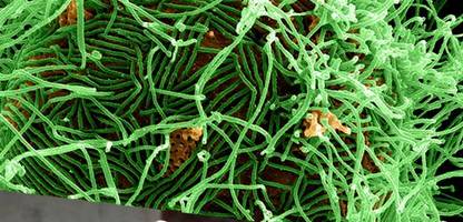 Ebola: Was Sie über das tödliche Virus wissen müssen