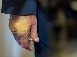 USA: Nach Gesundheitscheck bescheinigt Trump sich selbst: „Alles perfekt“