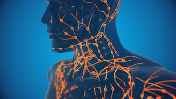 lymphdrüsenkrebs: ursachen, symptome und behandlung der krankheit im Überblick