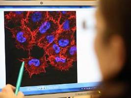 Zweifel an Aussagekraft: Neue mRNA-Impfung halbiert laut Studie Hautkrebs-Rückfallrisiko