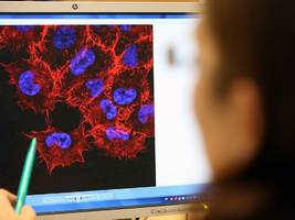 Onkologie: Der Durchbruch für die mRNA-Impfstoff gegen Krebs könnte bevorstehen