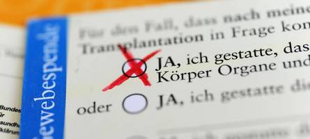 Organspende: eine Reform mit Tücken