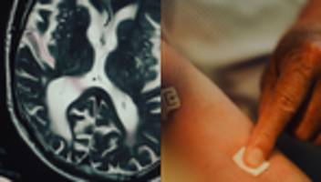 alzheimer-früherkennung: alzheimer-test beim hausarzt?