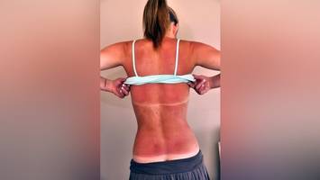 sonnencremes mit lsf 50 im test: viele halten den uv-schutz ein