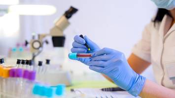 Ich bin jung, fit und habe Cholesterinwerte „eines alten, dicken Mannes“