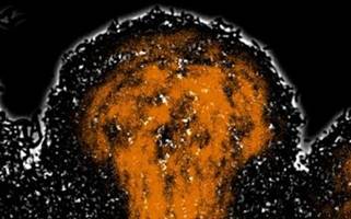 biologie: bakterien stoßen rettungskapseln ab