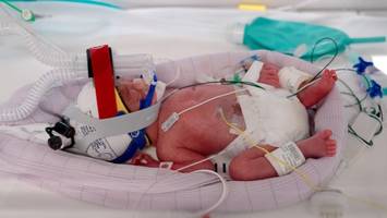 Eins zu 15 Millionen: Mutter aus Brisbane bringt eineiige Vierlinge zur Welt